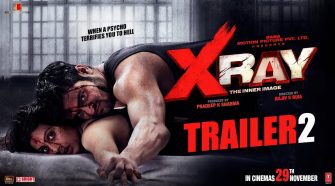 X ray movie